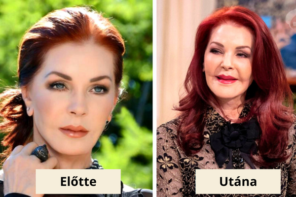 Priscilla Presley plasztika