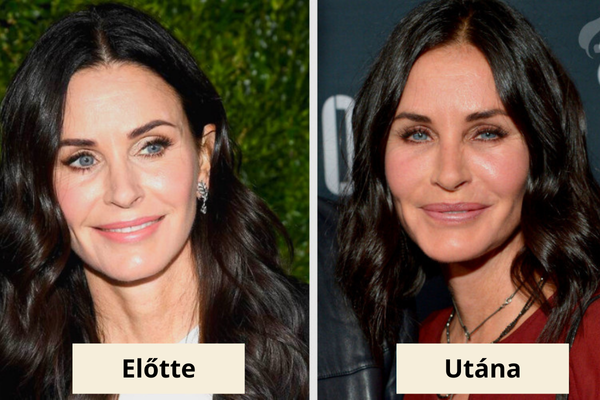 Courtney Cox plasztika