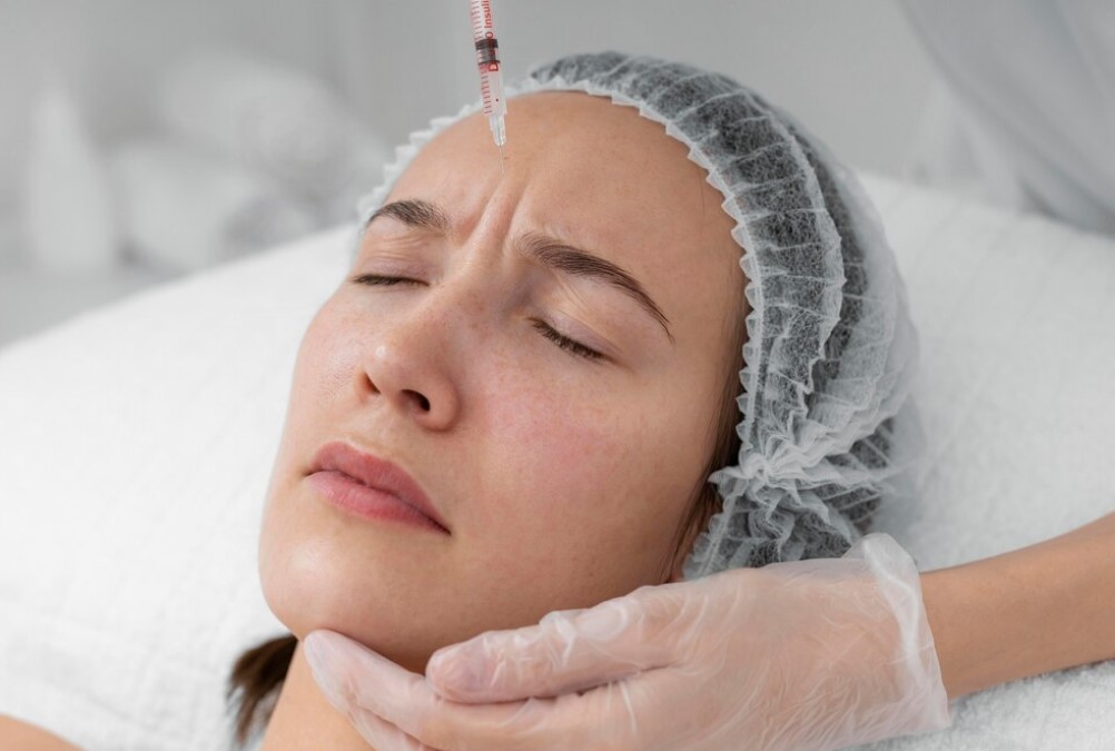 Glabella botox a homlokredők eltüntetésére.