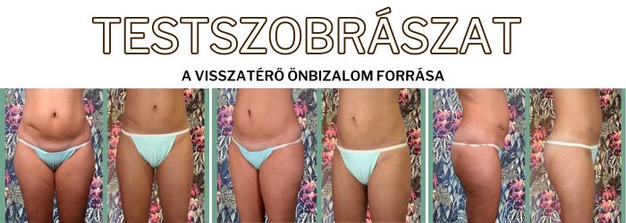 testszobrászat